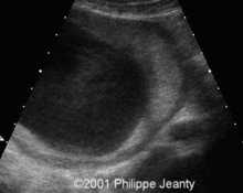 Placenta membranacea image