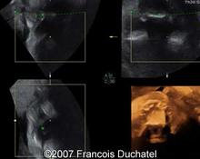 3D representation of the fetal hard palate image