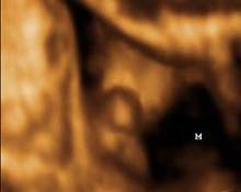 Male genitalia, 3D scans image