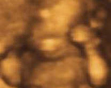 The development of the fetal face through 3D imaging image