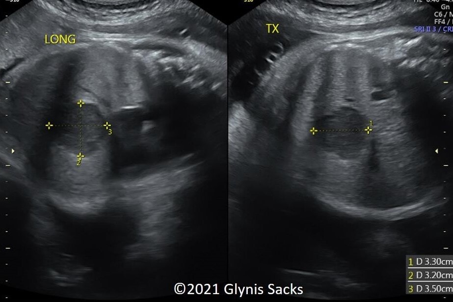 Picture1