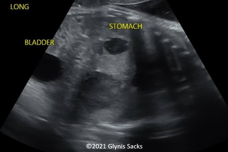 Picture2