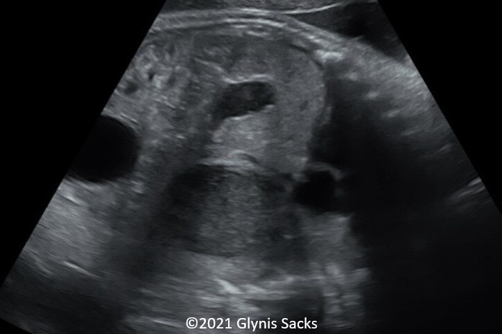 Picture4