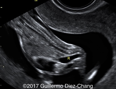 Image 1T 1