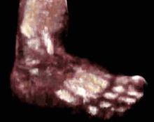 3D rendering of normal foot image