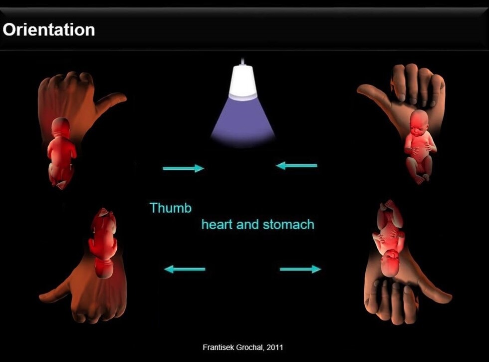 Left hand rule of thumb in transvaginal scanning