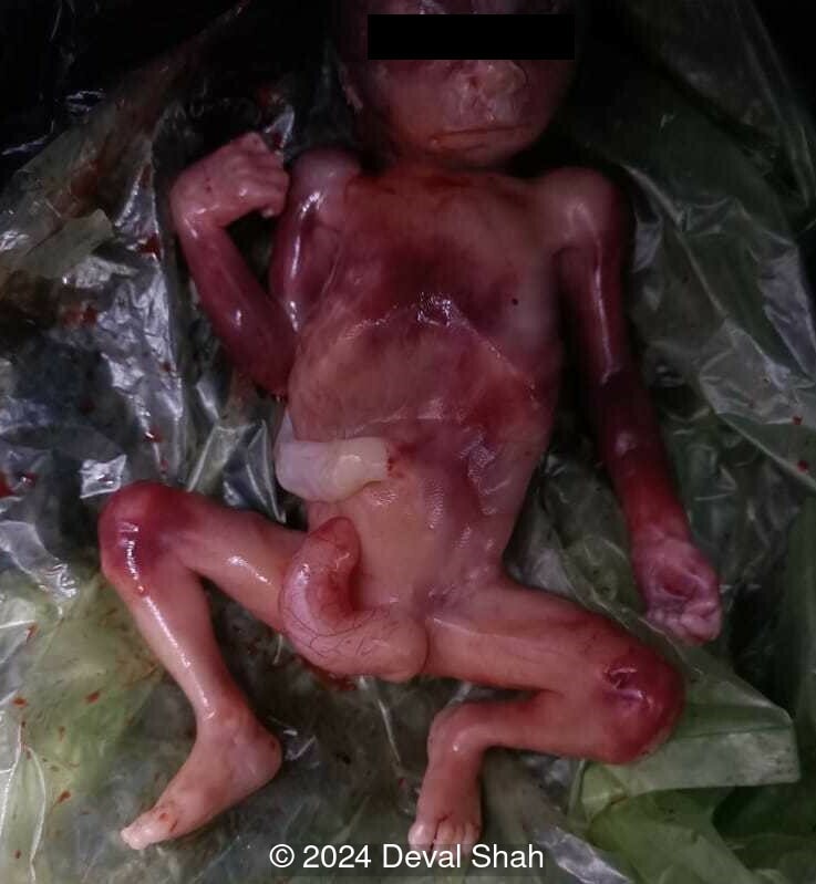Postnatal image after termination