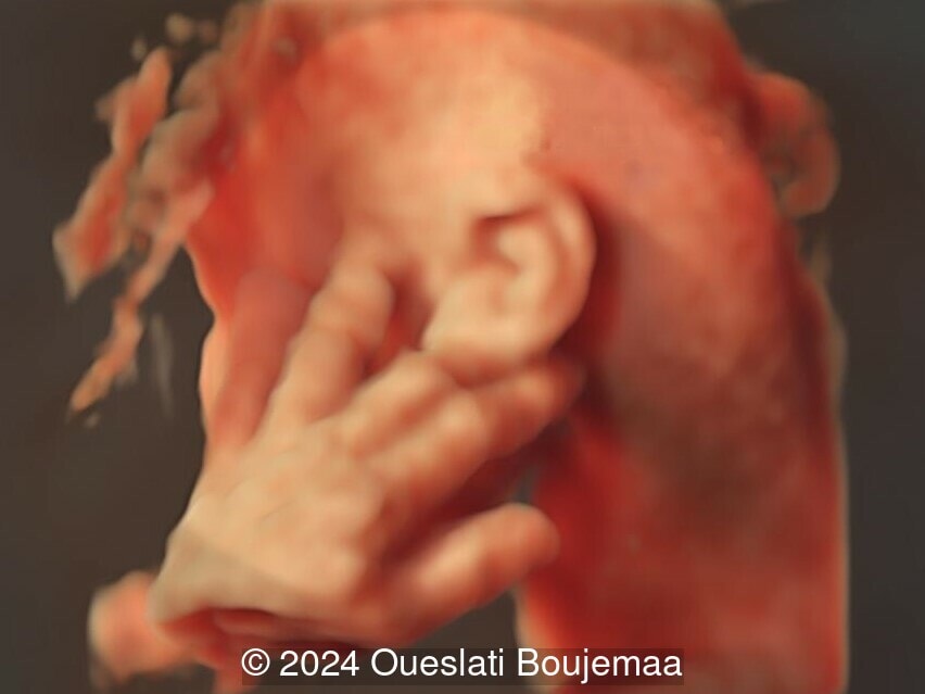 28 weeks gestation