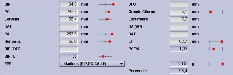30 weeks gestation. BIP: biparietal diameter; PC: head circumference; Cervelet: cerebellum; PA: Abdominal circumference; Humerus: humerus; LF: femur length; Grande cisterne: Cisterna magna; Carrefours: ventricular junction