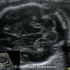 Case of the Week #624