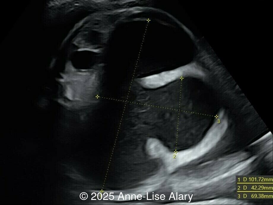 Axial image of the abdomen