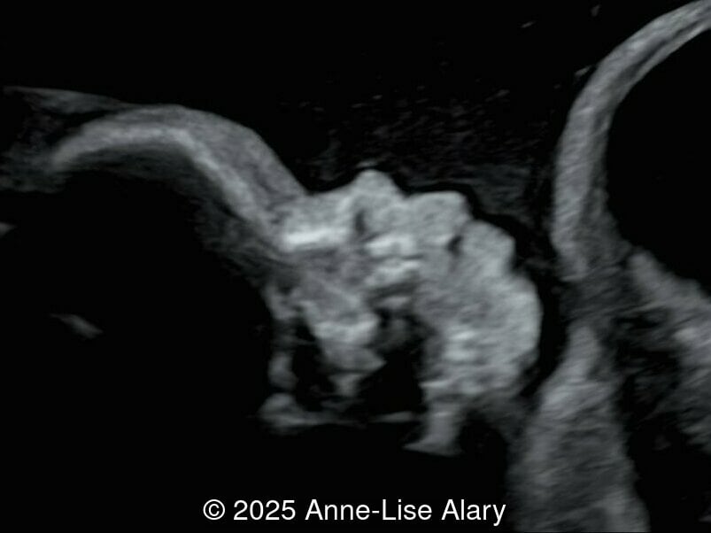 Sagittal image of the face