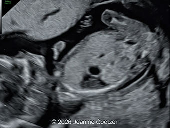 Case of the Week #643