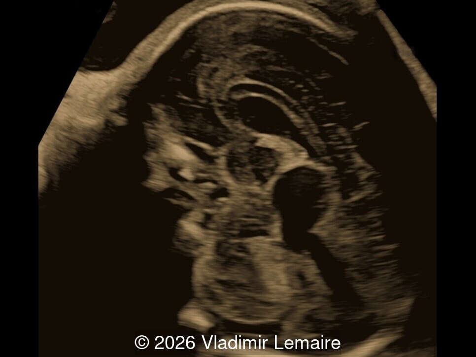 Sagittal image of the fetal head
